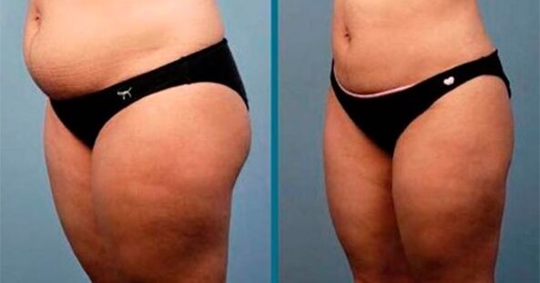 phương pháp giảm cân 10 kg trong một tháng